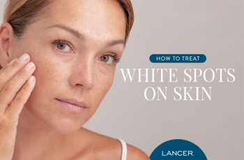 Common Skincare Causes of White Bumps and How to Treat Them Common Skincare Causes of White Bumps and How to Treat Them