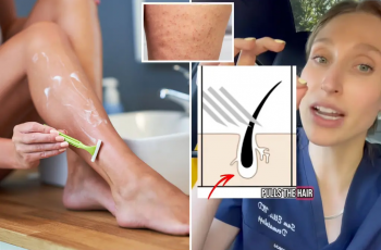The Shaving Mistake That Causes Dark Spots: How to Heal Ingrown Hairs Fast The Shaving Mistake That Causes Dark Spots: How to Heal Ingrown Hairs Fast
