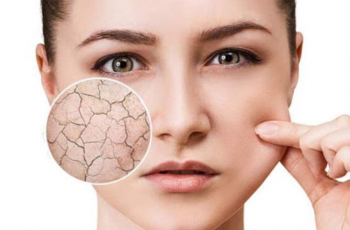 Understanding Dry and Dehydrated Skin: What You Need to Know